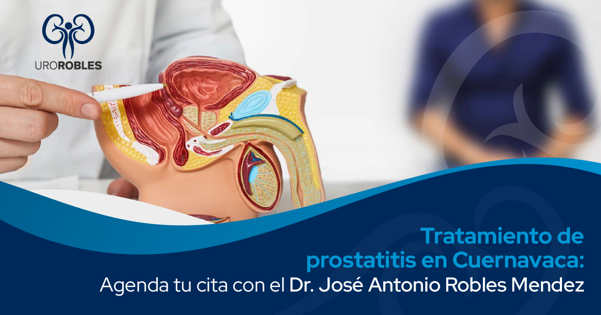 Tratamiento de prostatitis en Cuernavaca