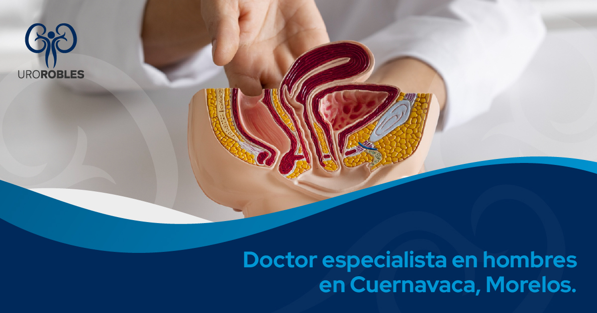 Doctor especialista en hombres en Cuernavaca